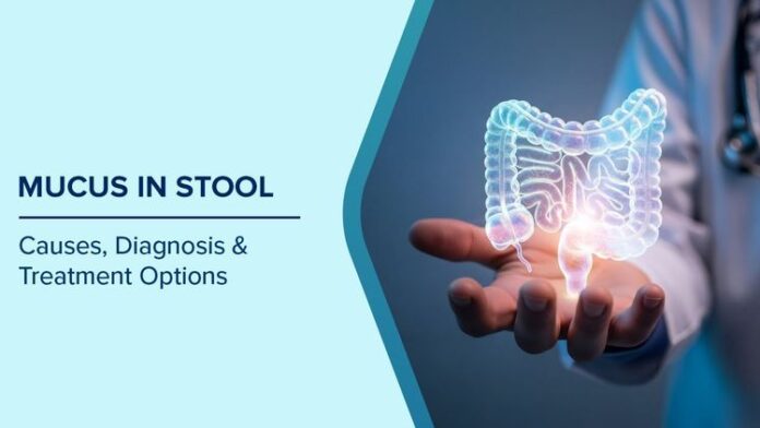 Mucus in Stool