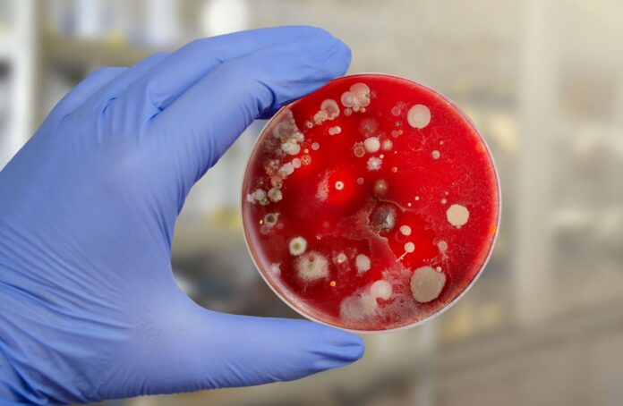 The Ultimate Guide to Mold Testing, Common Concerns, Detection Methods, and Solutions